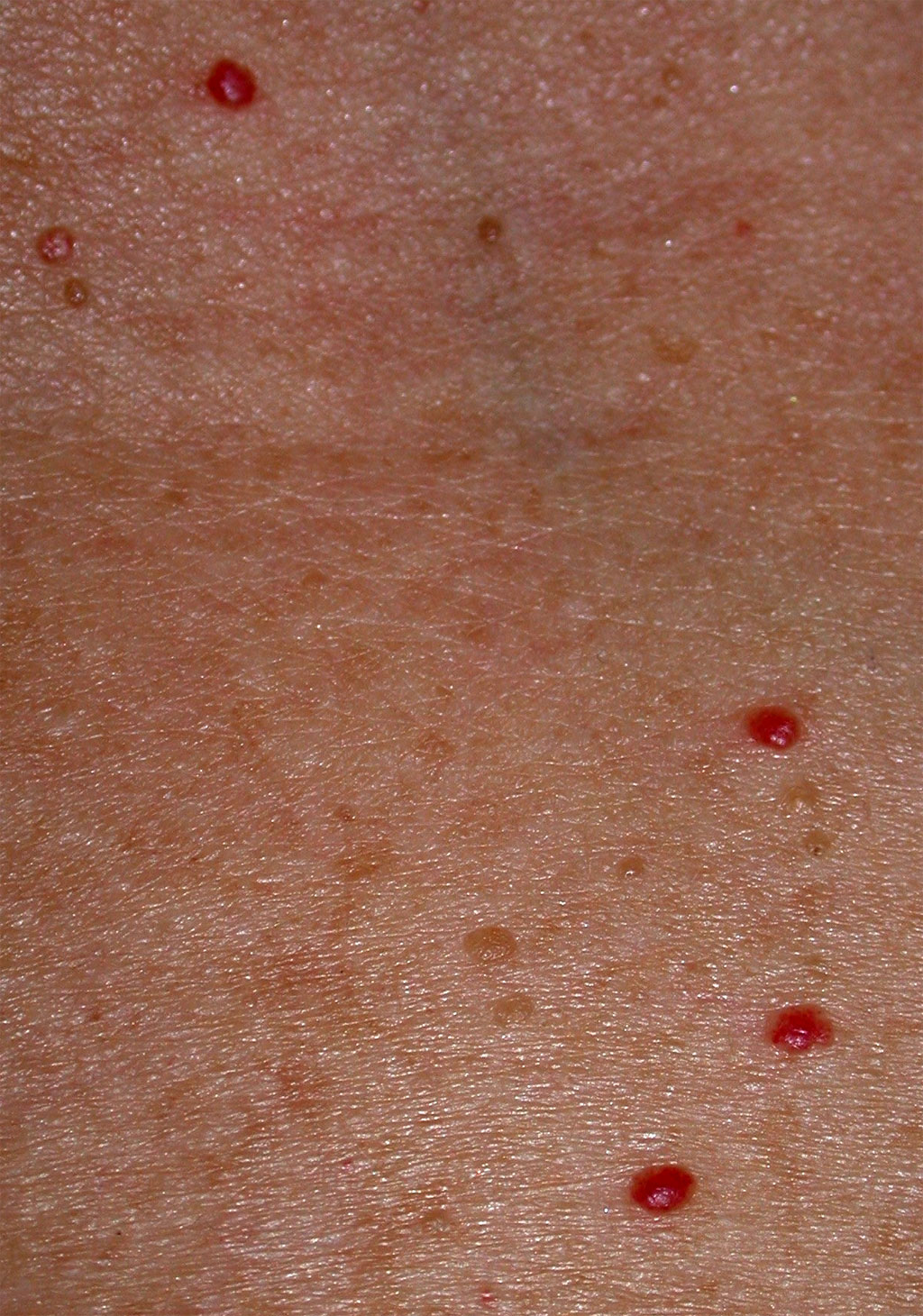 7-causes-of-red-spots-and-bumps-on-skin-with-pictures-allure